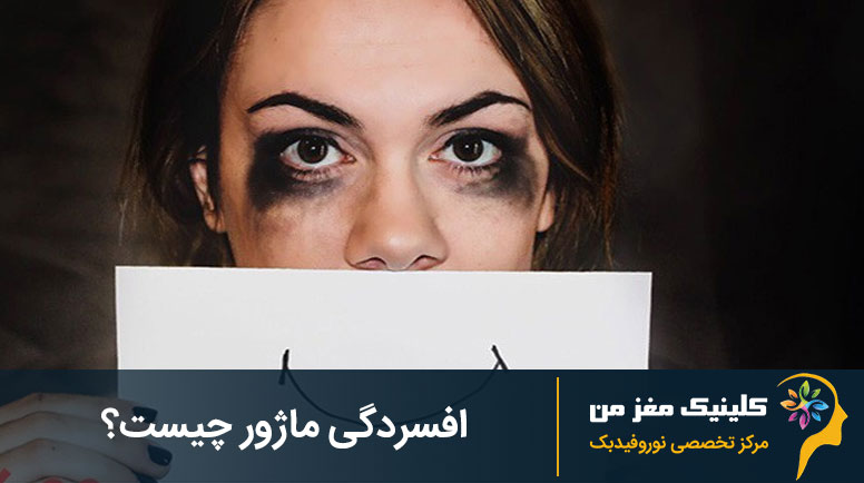 افسردگی ماژور