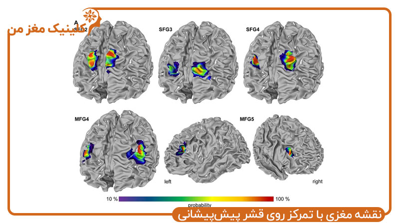 نقشه مغزی با تمرکز روی قشر پیش‌پیشانی