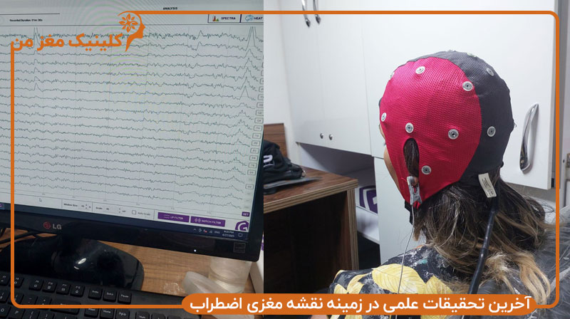 آخرین تحقیقات علمی در زمینه نقشه مغزی اضطراب​