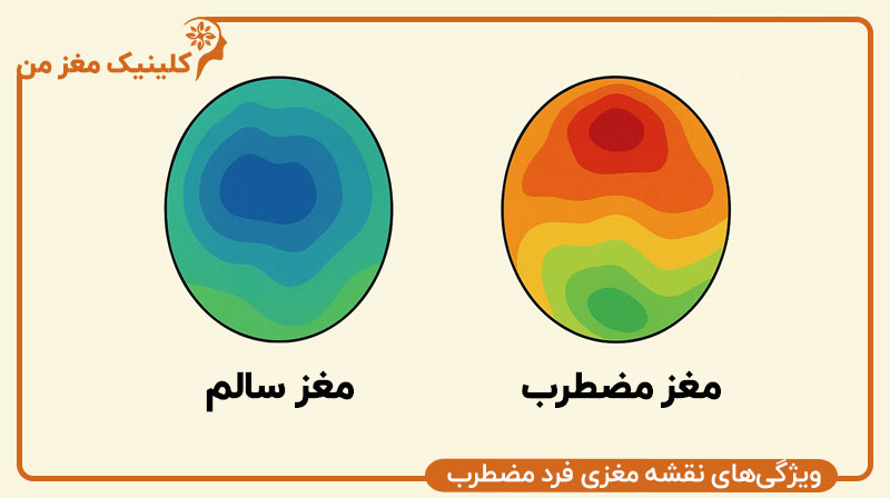 نقشه مغزی فرد مضطرب چه تفاوتی با فرد سالم دارد؟​