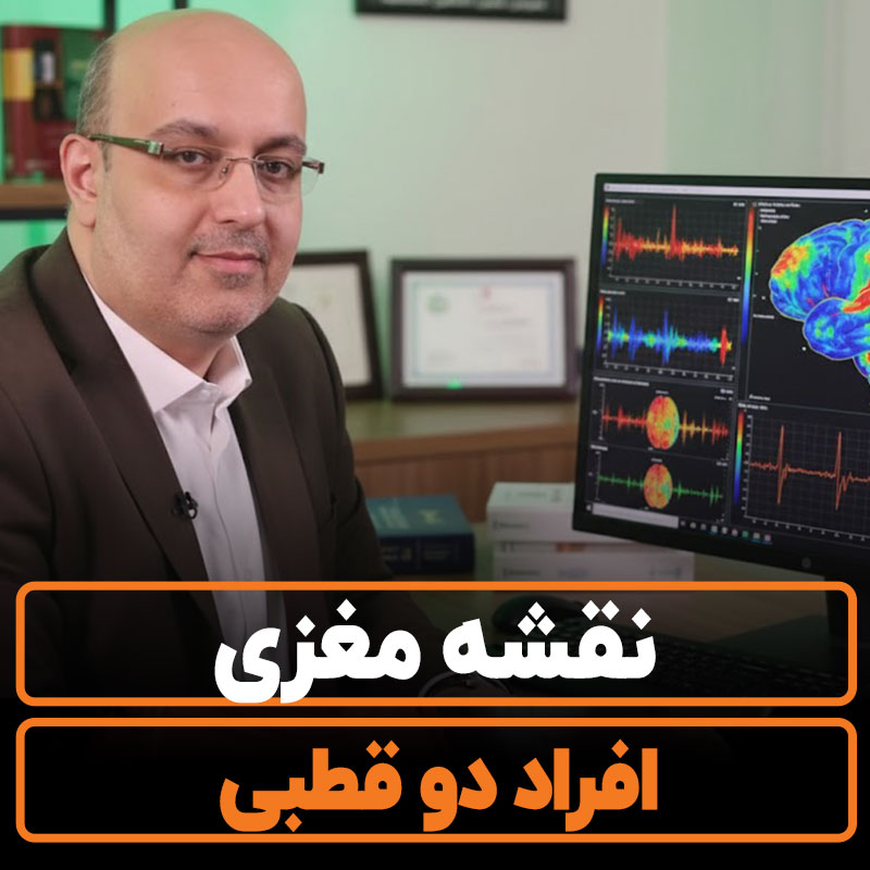 نقشه مغزی افراد دوقطبی【تحقیقات %%currentyear%% 】راهنمای تشخیص !!